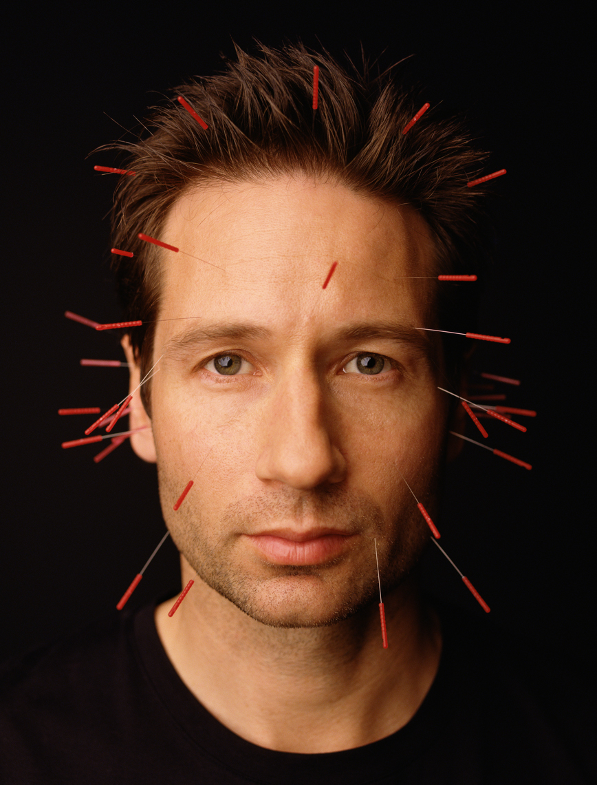 wDavid_Duchovny_Acupuncture_Needles